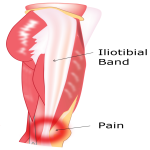 Iliotibial Band