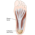 Plantar Fascia